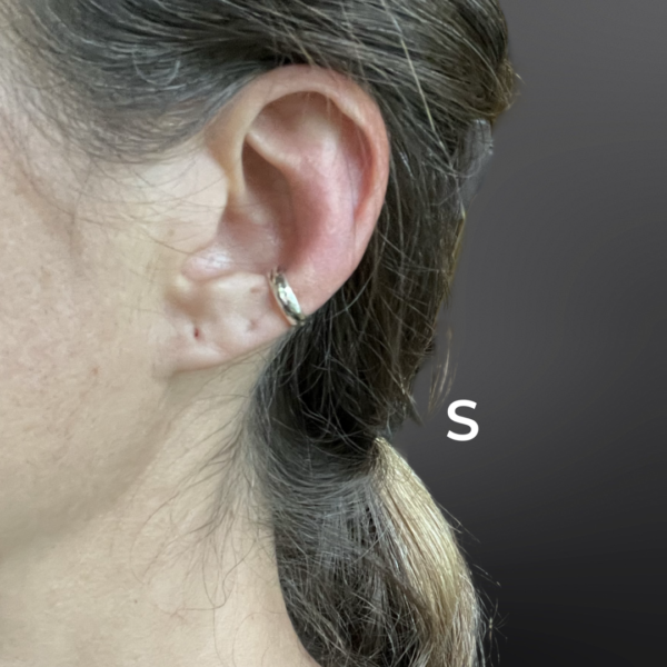 Arete Abrazo o Ear cuff - Image 4